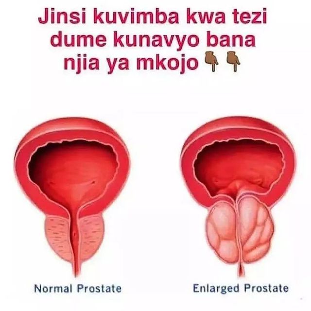 TEZI DUME SIO BUSHA FAHAMU KWA UNDANI